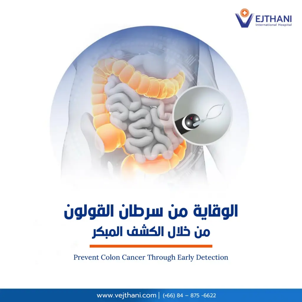 الوقاية من سرطان القولون من خلال الكشف المبكر

