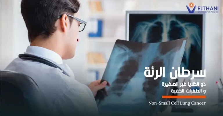 سرطان الرئة ذو الخلايا غير الصغيرة والطفرات الخفية