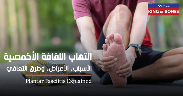 التهاب اللفافة الأخمصية