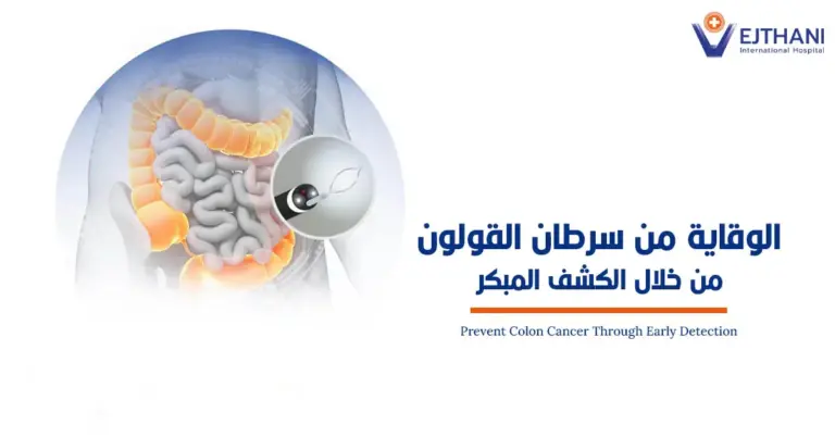 الوقاية من سرطان القولون من خلال الكشف المبكر