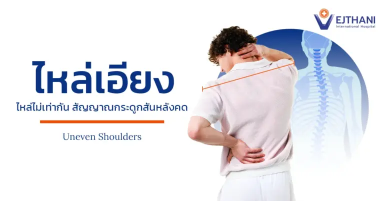 ไหล่ไม่เท่ากัน เกิดจากอะไร