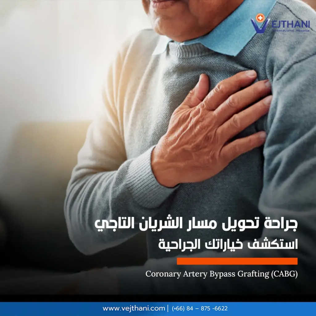 جراحة تحويل مسار الشريان التاجي

