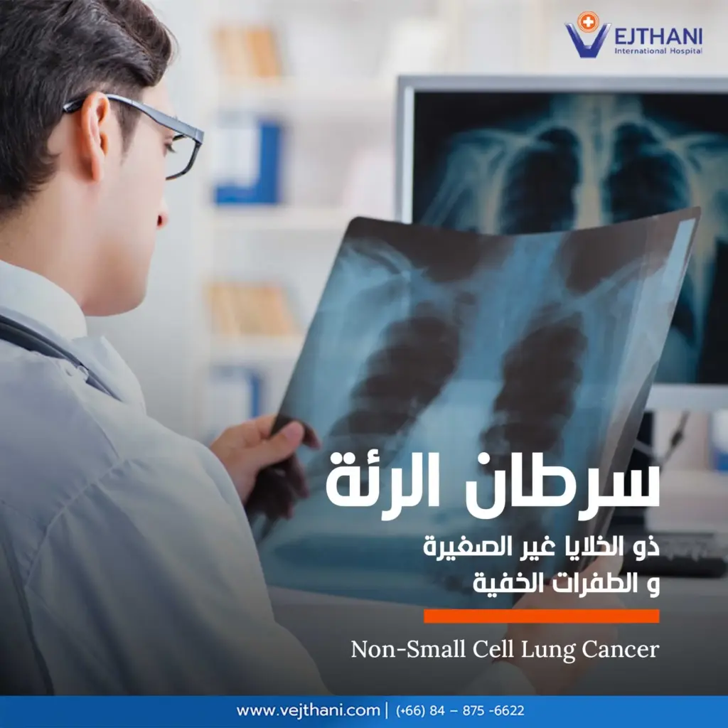 سرطان الرئة ذو الخلايا غير الصغيرة  والطفرات الخفية
