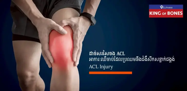 ការដាច់សរសៃចងឆ្អឹងមុខ ACL មិនមែនត្រឹមតែបង្ក​ការឈឺចាប់ និង​ប៉ះពាល់​ដល់​ជីវិត​ប្រចាំថ្ងៃ​របស់​អ្នក​ប៉ុណ្ណោះ​ទេ ប៉ុន្តែ​ប្រសិនបើ​មិន​បាន​ព្យាបាល វា​អាច​នាំ​ឱ្យ​កើតជាជំងឺសឹកសន្លាក់ជង្គង់មុនអាយុដែលត្រូវកើតដោយសារតែសន្លាក់ជង្គង់គ្មានស្ថេរភាព