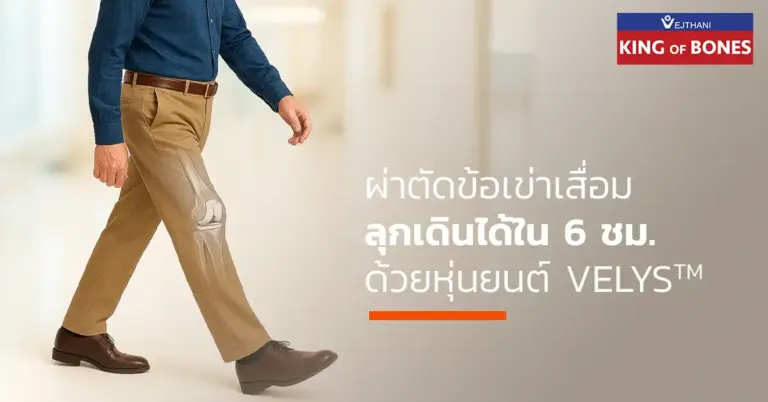 ข้อเข่าเสื่อม