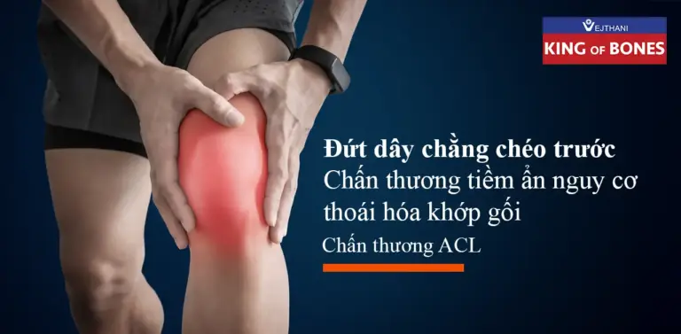 Đứt dây chằng chéo trước thường do chấn thương khi chơi thể thao hoặc té ngã làm xoay gối đột ngột. Bệnh gây đau, sưng và lỏng khớp gối. Điều trị bằng tập phục hồi hoặc phẫu thuật tùy mức độ tổn thương