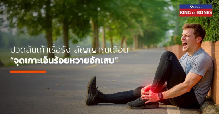 เอ็นร้อยหวาย