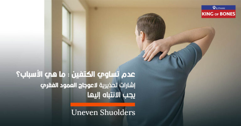 عدم تساوي مستوى الكتفين : ما هي الأسباب؟ إشارات تحذيرية لاعوجاج العمود الفقري ( الجنف)يجب الانتباه إليها
