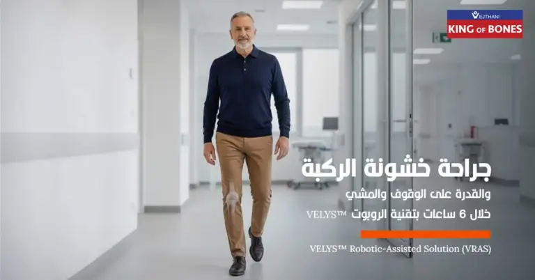 جراحة خشونة الركبة… والقدرة على الوقوف والمشي خلال 6 ساعات بتقنية الروبوت VELYS