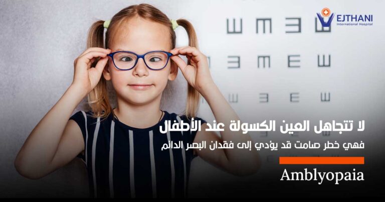 العين الكسولة