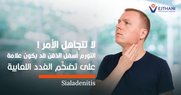 الغدد اللعابية