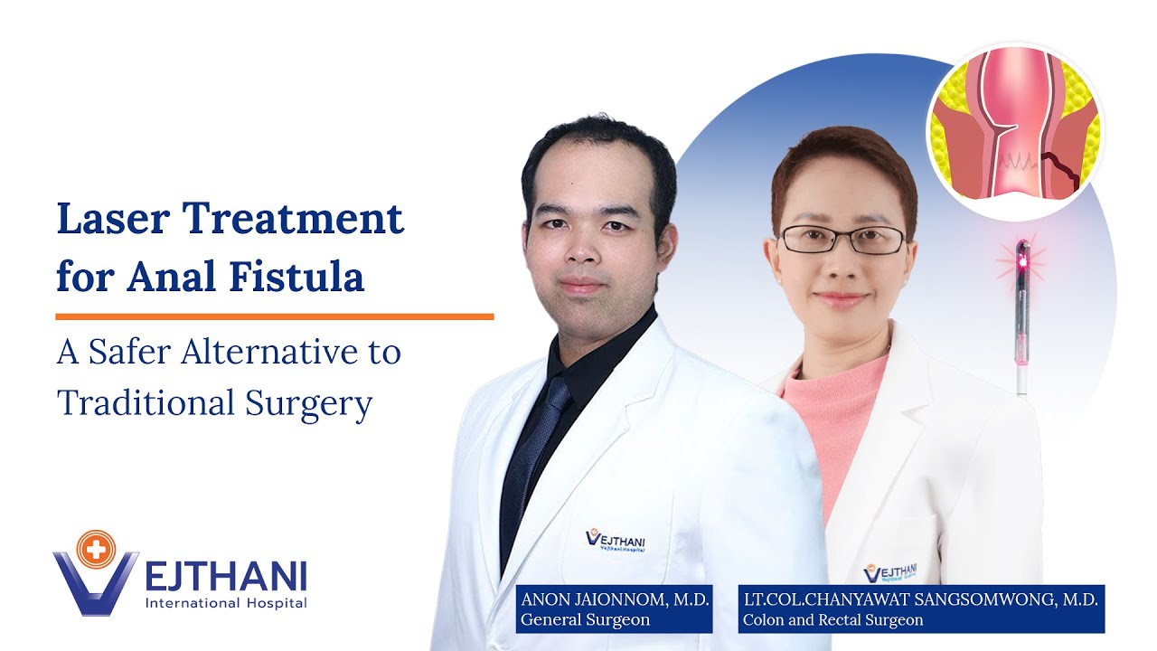Treating Anal Fistula Through FiLaC — The Advanced Laser Technique | Vejthani Hospital