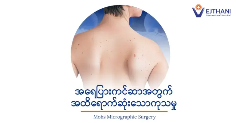 အရေပြားကင်ဆာကုသခြင်းအတွက် လူနာအတွက်သက်တောင့်သက်သာဖြစ်စေပြီး တိကျသေချာစေမည့် ခွဲစိတ်ခြင်းနည်းပညာ
