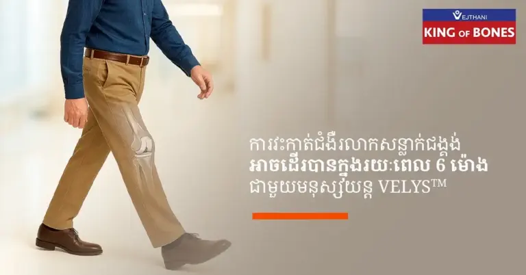 មនុស្សភាគច្រើនអាចដើរបានក្នុងរយៈពេលប្រាំមួយម៉ោងបន្ទាប់ពីការវះកាត់ជំងឺរលាកសន្លាក់ជង្គង់ជាមួយមនុស្សយន្ត VELYSTM ហើយត្រឡប់ទៅសកម្មភាពប្រចាំថ្ងៃរបស់ពួកគេវិញយ៉ាងឆាប់រហ័ស