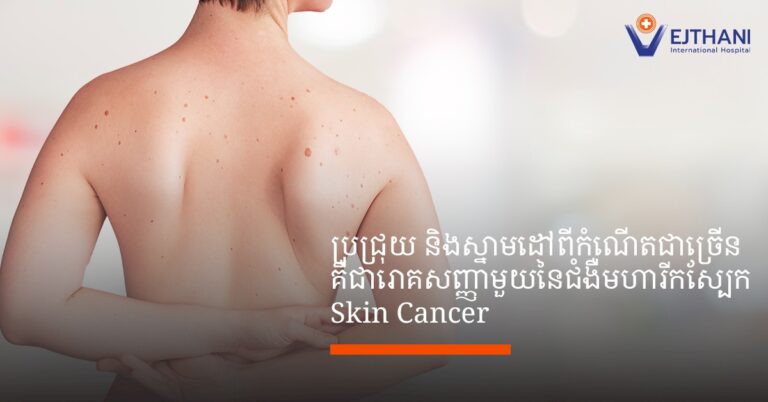 មហារីកស្បែក