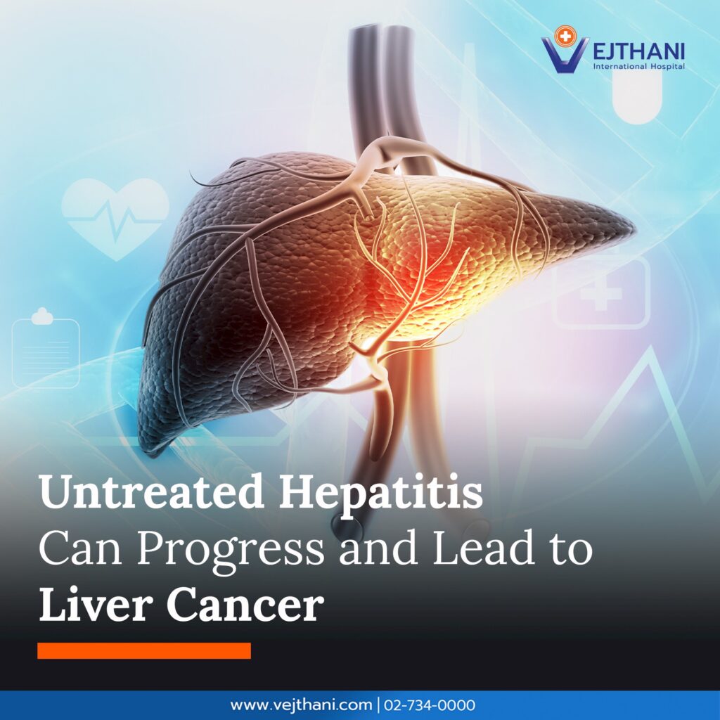Liver Cancer