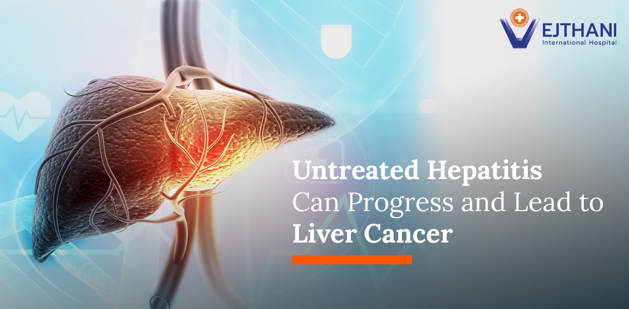 Untreated Hepatitis Can Progress and Lead to Liver Cancer