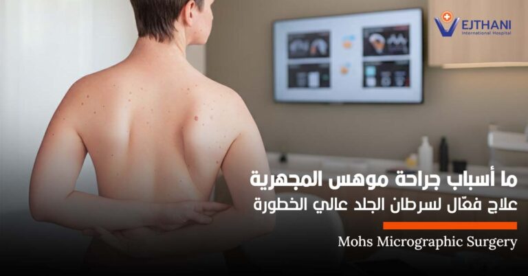 سرطان الجلد