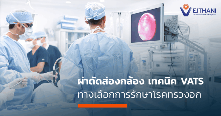 ผ่าตัดส่องกล้อง