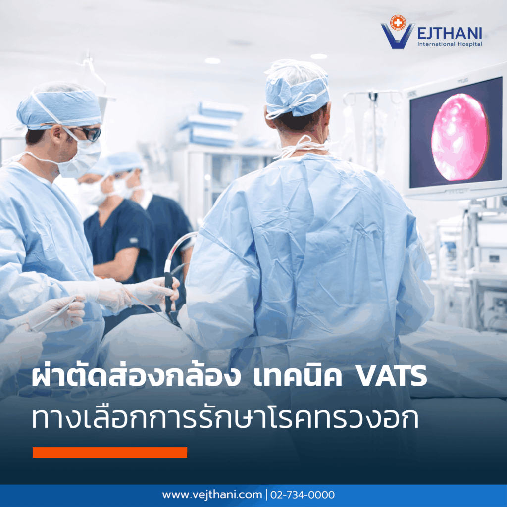 ผ่าตัดส่องกล้อง