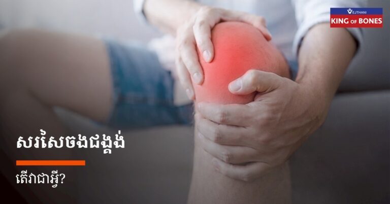 សរសៃចងជង្គង់