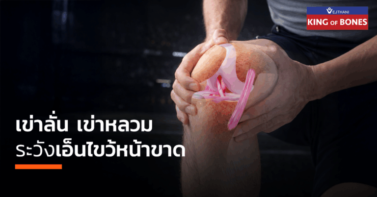 เอ็นไขว้หน้าขาด