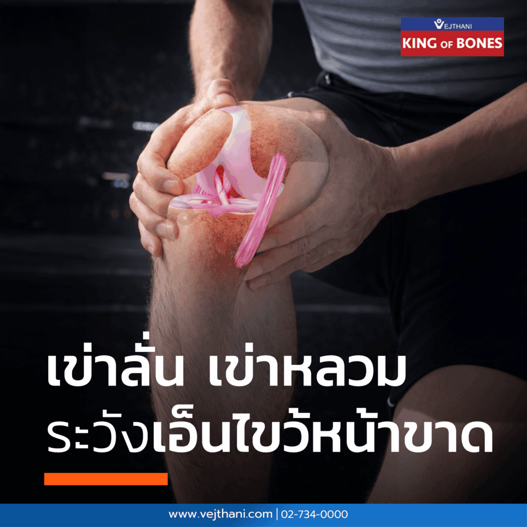 เอ็นไขว้หน้าขาด