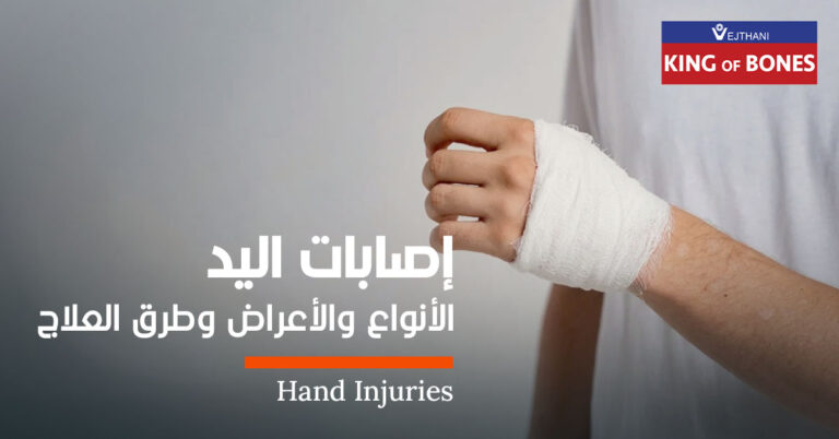 إصابات اليد