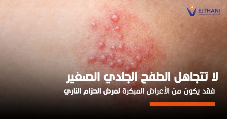 الحزام الناري