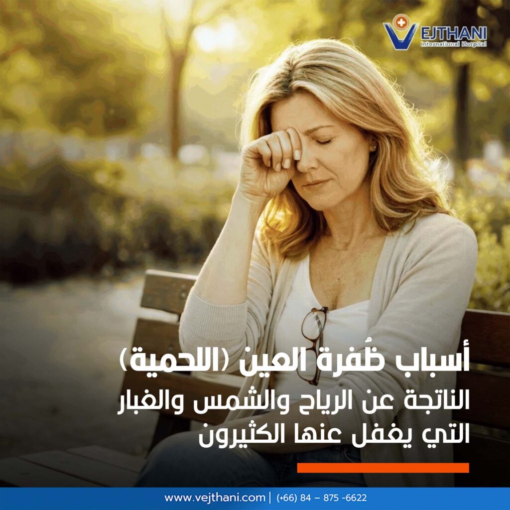 ظفرة العين 