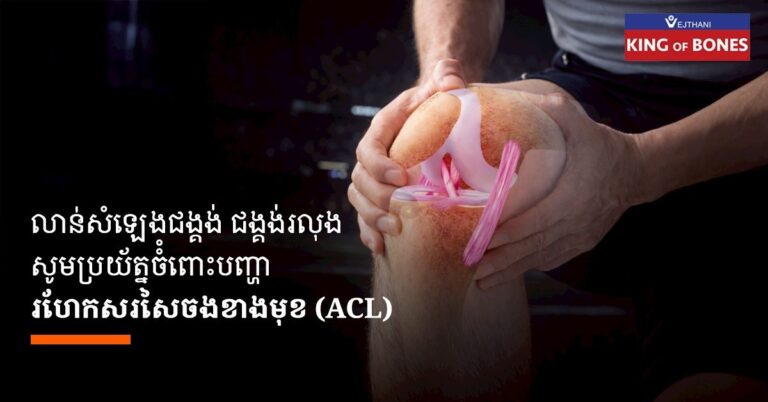 ការរហែកសរសៃចងខាងមុខ