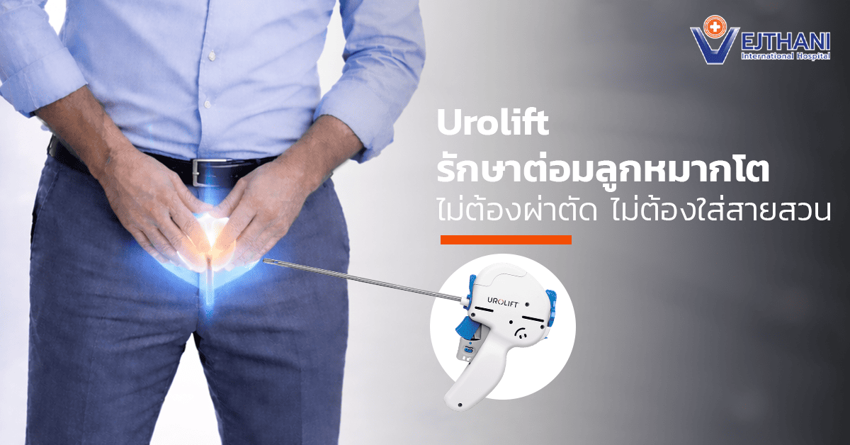 Urolift รักษาต่อมลูกหมากโต ไม่ต้องผ่าตัด ไม่ต้องใส่สายสวน