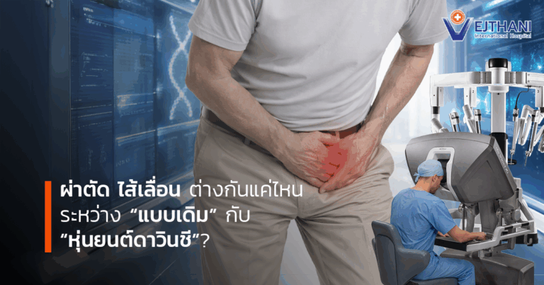 ผ่าตัด ไส้เลื่อน
