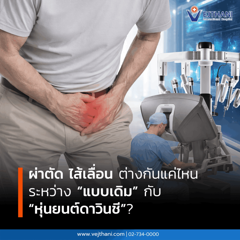 ผ่าตัด ไส้เลื่อน
