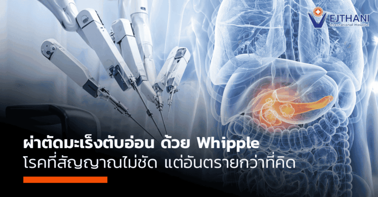 มะเร็งตับอ่อน