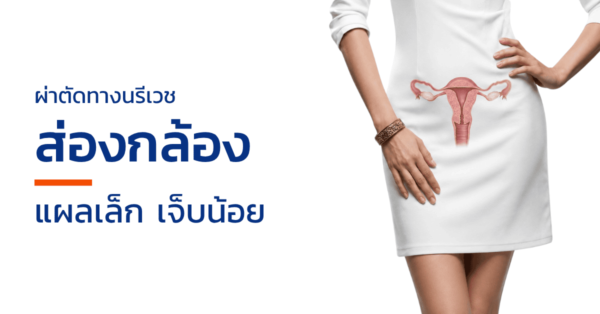 ผ่าตัดทางนรีเวชส่องกล้อง แผลเล็ก เจ็บน้อย ฟื้นตัวไว