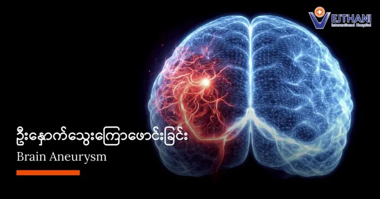 ဦးနှောက်သွေးကြောဖောင်းခြင်း