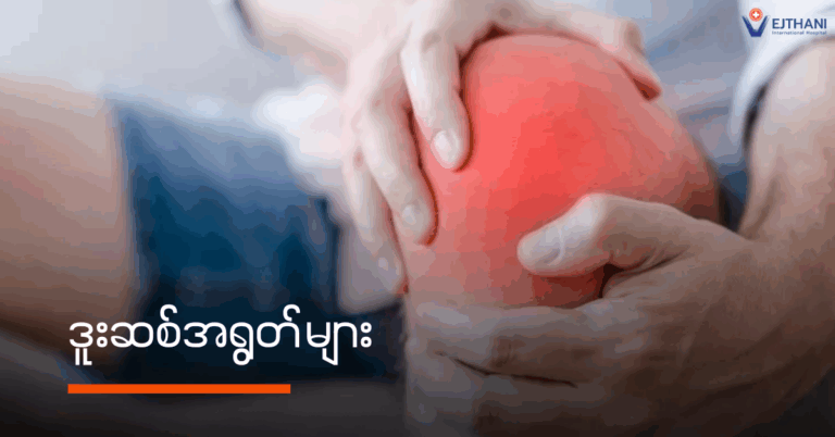 ဒူးဆစ်အရွတ်များ