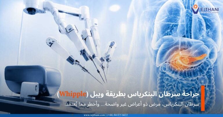 جراحة سرطان البنكرياس
