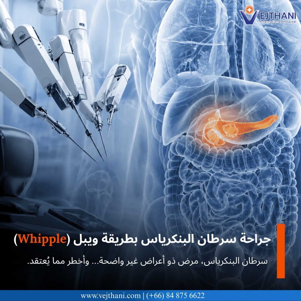 جراحة سرطان البنكرياس