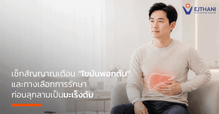 ไขมันพอกตับ