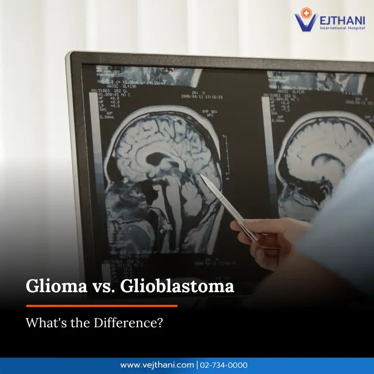 Glioma vs. Glioblastoma