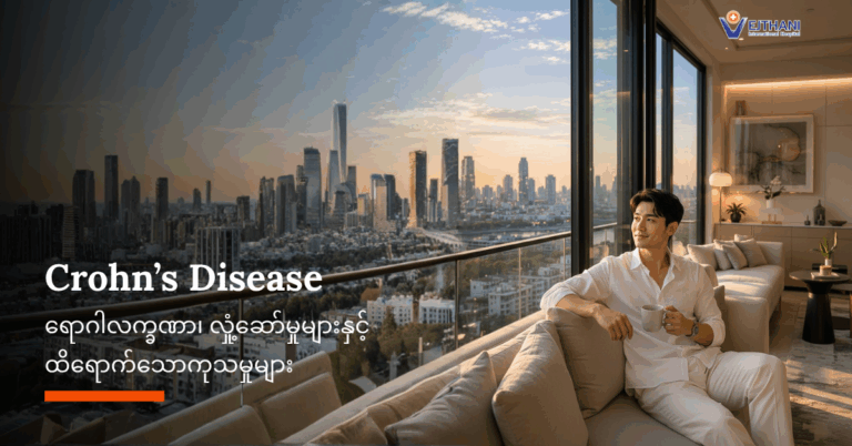 Crohn’s ရောဂါ