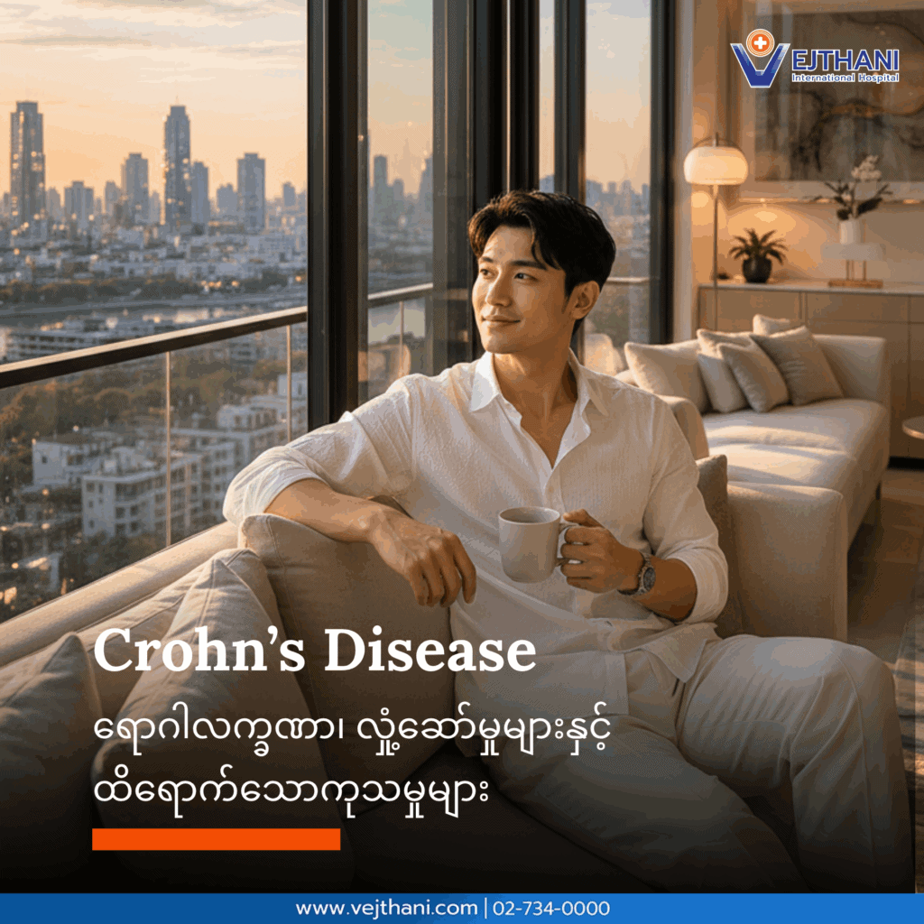 Crohn’s ရောဂါ
