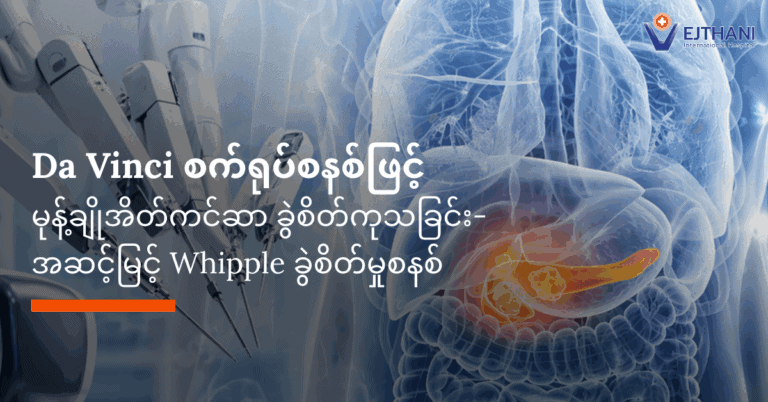 မုန့်ချိုအိတ်ကင်ဆာ