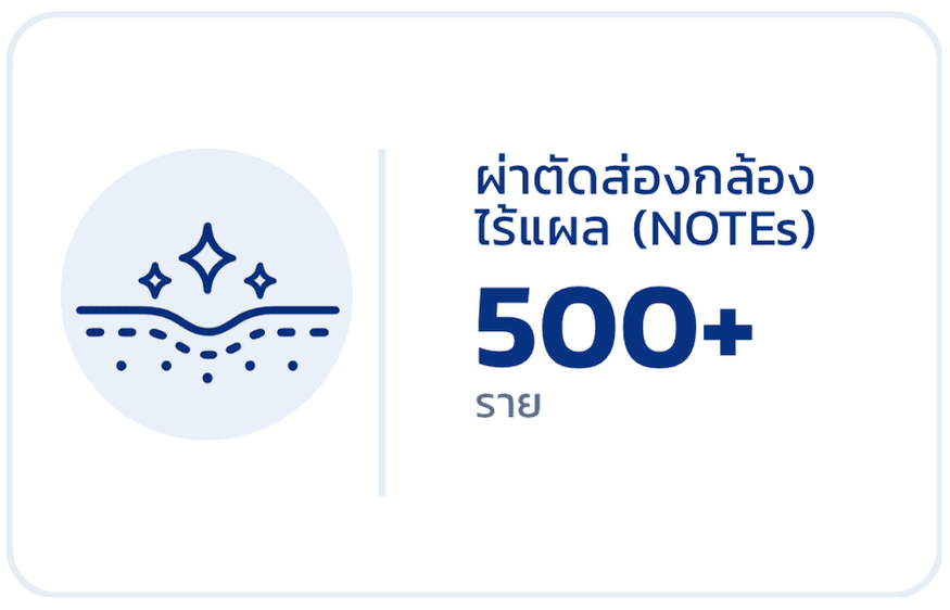 ผ่าตัดส่องกล้องไร้แผล NOTES