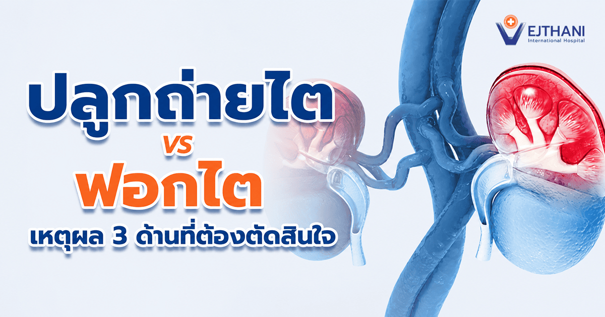 ปลูกถ่ายไต vs ฟอกไต เหตุผล 3 ด้านที่ต้องตัดสินใจอย่างรอบคอบ