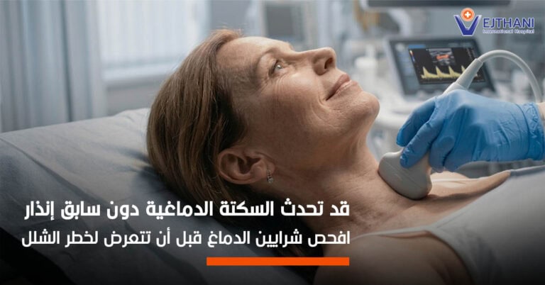 السكتة الدماغية