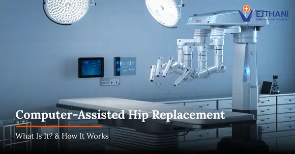 Computer-Assisted Hip Replacement