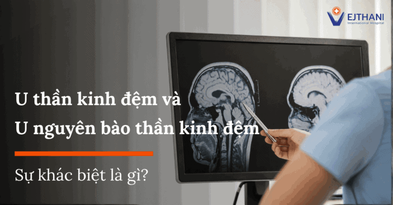 U não đệm (Glioma) và U nguyên bào thần kinh đệm (Glioblastoma): Làm thế nào để phân biệt?